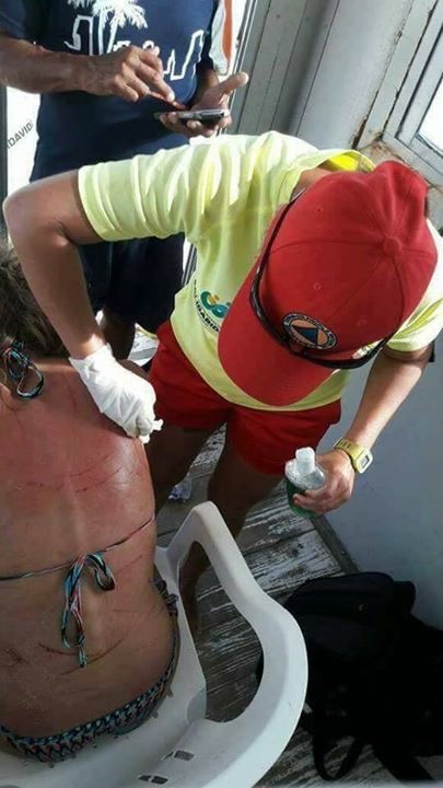 LESIONA LADRÓN A TURISTA DURANTE ATRACO