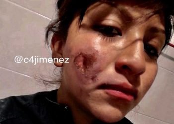 ‘Feministas me quemaron ayer y yo solo deseo poder sanar’