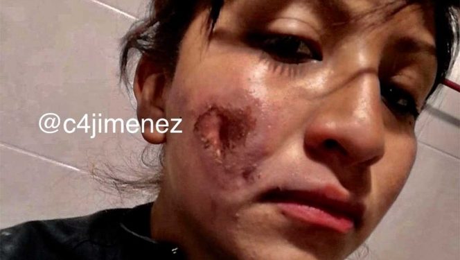 ‘Feministas me quemaron ayer y yo solo deseo poder sanar’