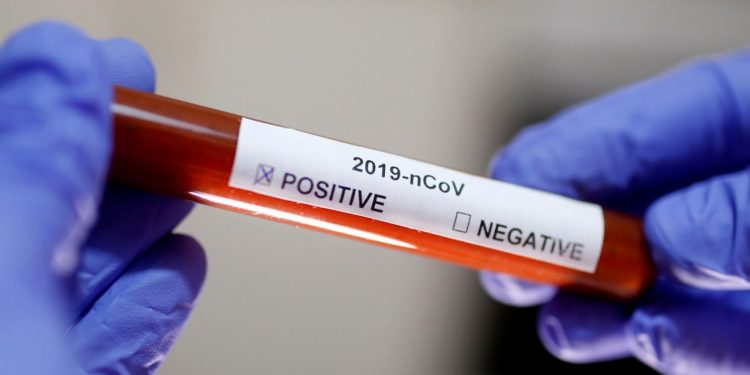 Dan de alta a la primera mujer que dio positivo de Covid-19 en Q. Roo