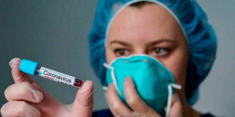 Lo que sabemos de las pruebas diagnóstico para el Covid-19