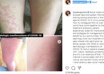 Se descubre nuevo posible síntoma de covid-19 que ataca sobre todo a jóvenes