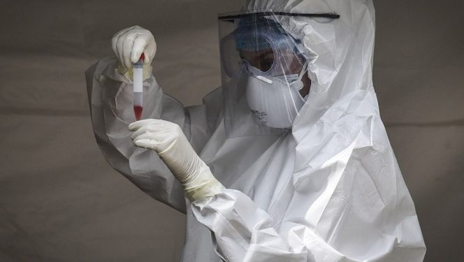 Esta es la prueba Covid que da resultado en sólo 90 minutos