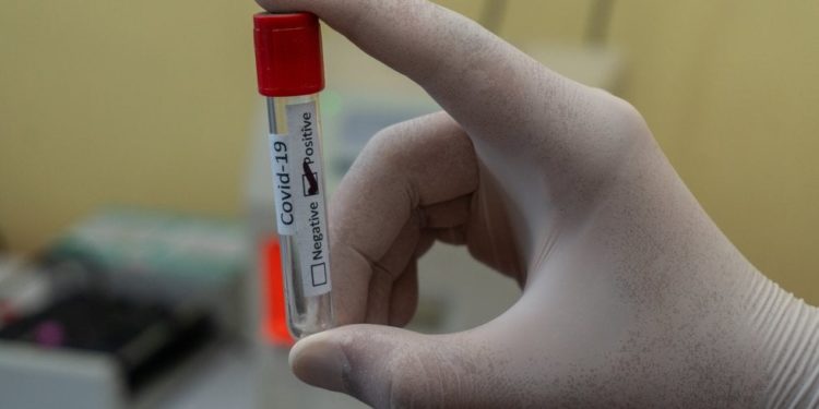 Mielitis transversa: la enfermedad que frenó los ensayos de la vacuna contra el COVID-19