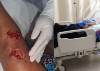 Dueño del perro responderá por las mordidas a una mujer en Isla Mujeres