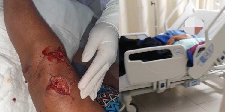 Dueño del perro responderá por las mordidas a una mujer en Isla Mujeres