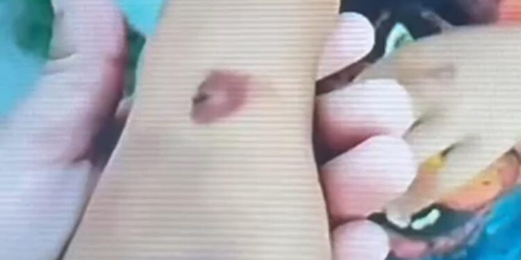 Abuela se hará cargo de niño quemado en Villas del Sol